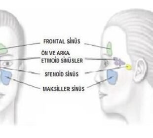 Paranazal sinüslerde mukozal kalınlaşma nedir