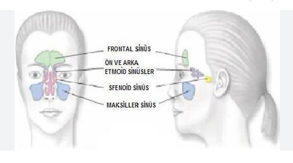 Paranazal sinüslerde mukozal kalınlaşma nedir