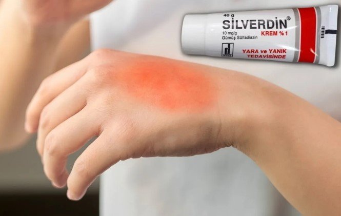 Silverdin krem nedir, ne için kullanılır